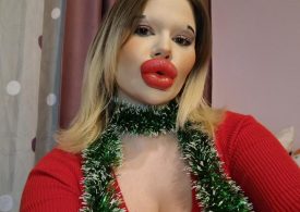 I have the world’s biggest lips and want them even bigger for Christmas – even if they scare off men