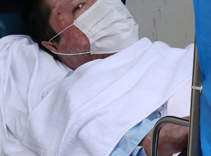 Blistered arsonist Shinji Aoba who burned 36 people alive & screamed ‘drop dead’ sentenced to DIE by ‘long drop hanging’