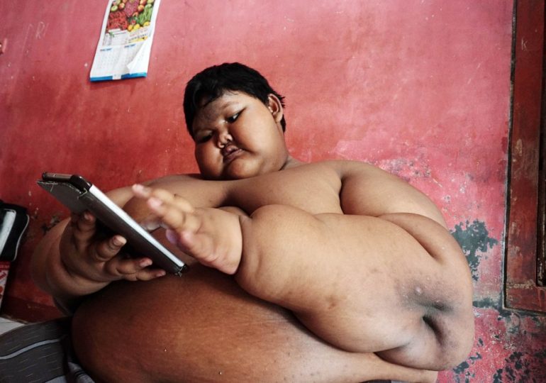 I was world’s fattest boy who weighed 30st and could only wash in a custom-built outdoor pool – now I’m unrecognisable