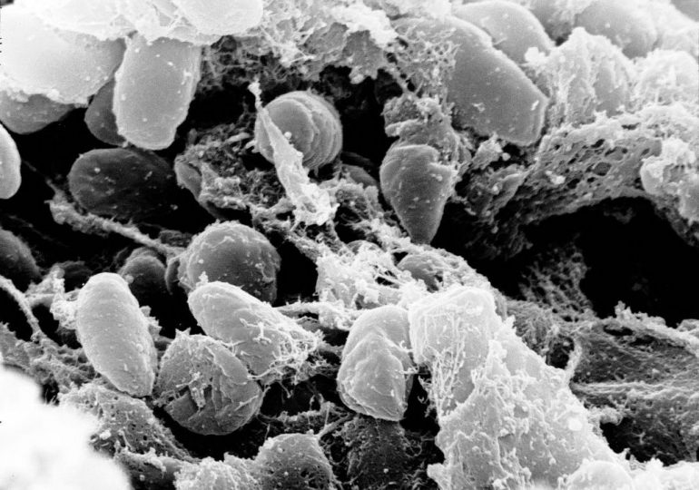 Colorado Plague Case Is a Reminder That the ‘Black Death’ Never Really Went Away