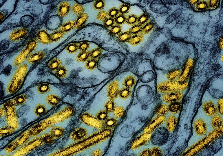 The First Child in the U.S. Has Been Diagnosed With Bird Flu