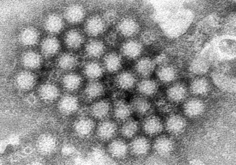 Nasty Norovirus Is Back in Full Force