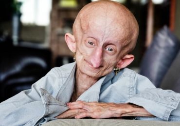 TikTok superstar Beandri Booysen dies aged 19 losing battle to make it to Christmas while fighting super-aging disease