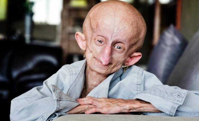 TikTok superstar Beandri Booysen dies aged 19 losing battle to make it to Christmas while fighting super-aging disease