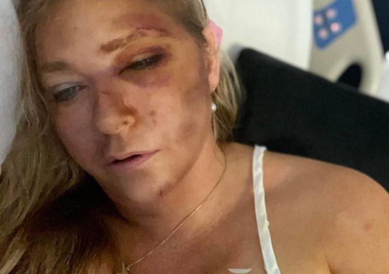 Andrew accuser Virginia Giuffre claims husband abused her before she ‘accidentally’ said bus crash left her near death