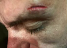 British dad-of-two was ‘beaten up twice in hotel’ in front of his children during ‘nightmare’ Turkish holiday