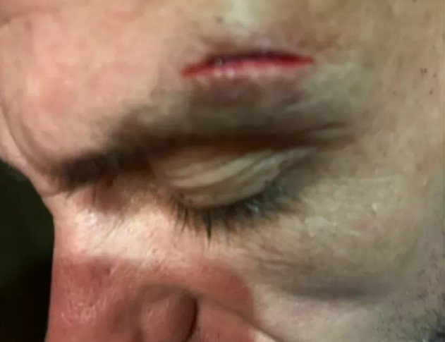 British dad-of-two was ‘beaten up twice in hotel’ in front of his children during ‘nightmare’ Turkish holiday