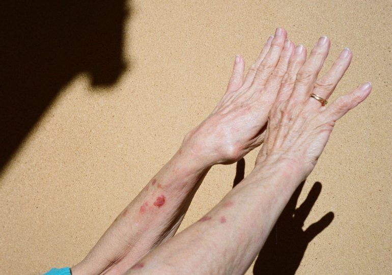 What My Two 98-Year-Old Patients Taught Me About Longevity