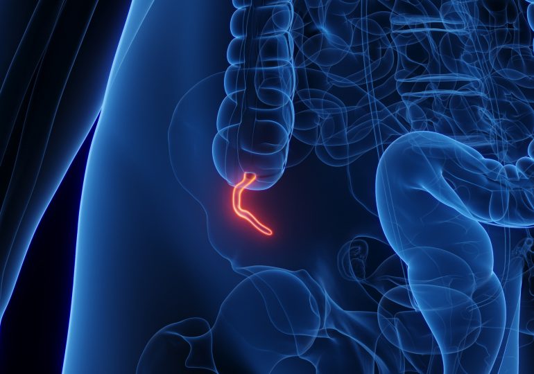 Appendix Cancer Has Quadrupled in Millennials