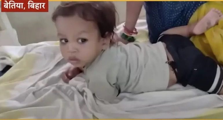 Fearless toddler, 2, bites COBRA to death after venomous snake attacked him
