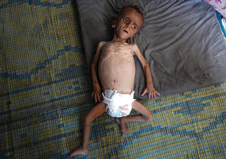 We Can Stop Gazans From Dying of Starvation Right Now. Here’s How We Do It