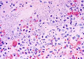 A Person in Arizona Has Died From Plague. Who’s Most at Risk of Contracting It, and How Can You Protect Yourself?