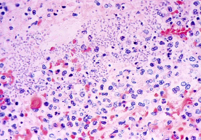 A Person in Arizona Has Died From Plague. Who’s Most at Risk of Contracting It, and How Can You Protect Yourself?