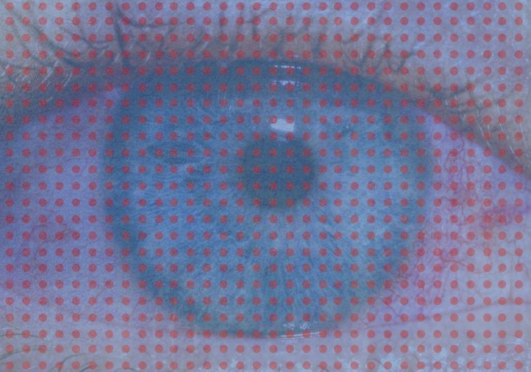 What to Do About Your Red, Itchy Eyes