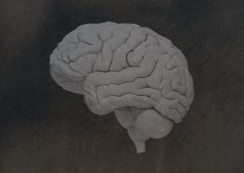 What to Know About the Brain Disease CTE