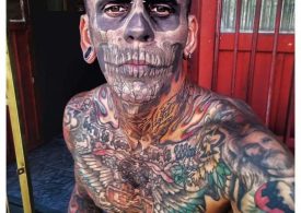 Tattoo addict who inked 95% of his body looks unrecognisable as he shows off results of painful procedure to remove them