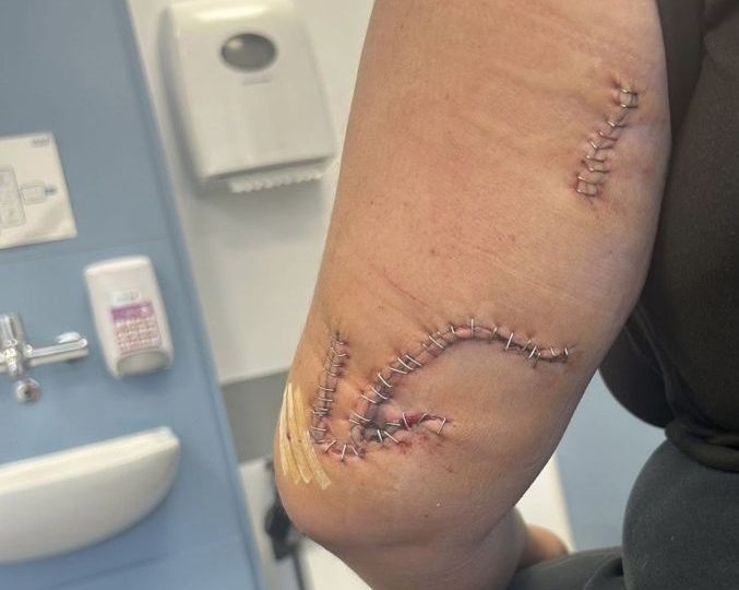 Brit, 19, was ‘stabbed with broken GLASS BOTTLE’ by tourist while walking back to Benidorm hotel after family night out