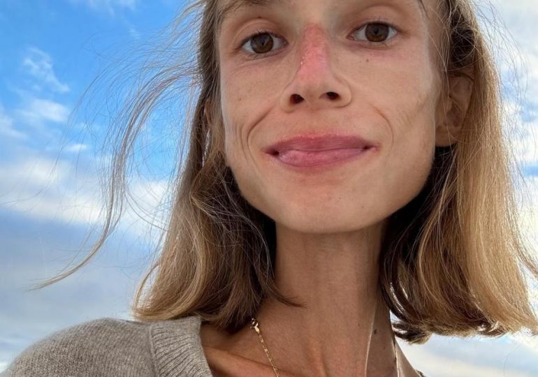 Student who adopted vegan ‘fruitarian’ diet at Brit uni starves to death in Bali hotel room weighing just 3.5 stone