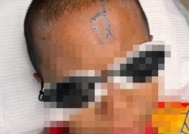 Boy, 10, is left humiliated after having vulgar word written across his FOREHEAD by bullies using a makeshift tattoo gun
