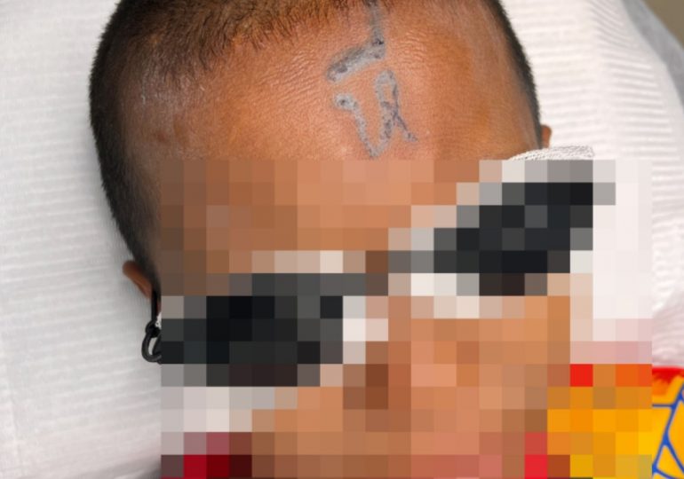 Boy, 10, is left humiliated after having vulgar word written across his FOREHEAD by bullies using a makeshift tattoo gun