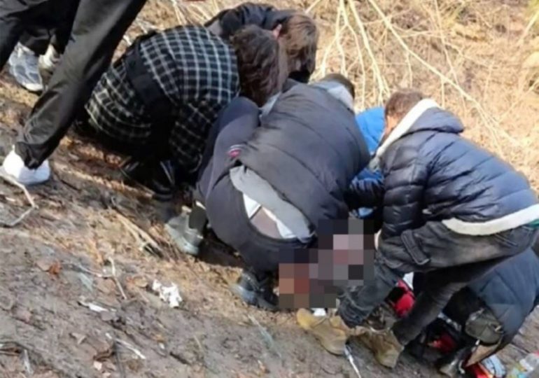 Putin drone blows off leg of Ukrainian mum, 21, in front of her four-year-old daughter left with ‘severe’ face wounds
