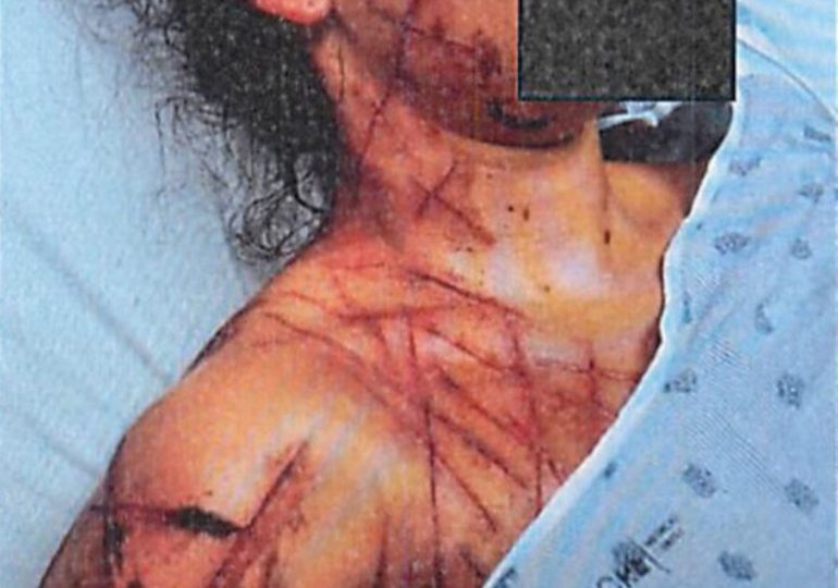 Ex-Republican staffer, 26, found hogtied & mutilated in ‘fake anti-Trump attack’ ordered to get mental health treatment