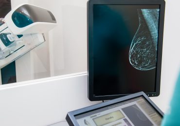 A New Study Challenges the Way We Screen for Breast Cancer