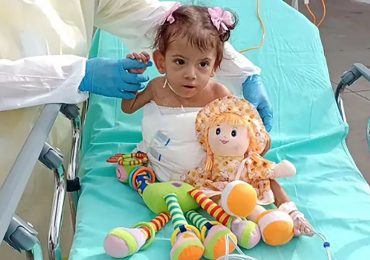 Conjoined twin who survived separation operation from her sister dies at Christmas just months after surgery