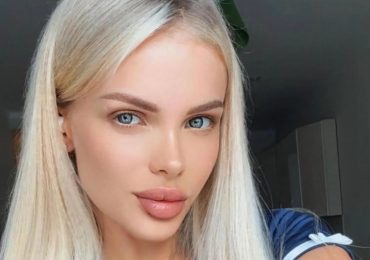 Glam model, 33, left fighting for life after vanishing for two weeks & suffering brutal beating requiring brain surgery