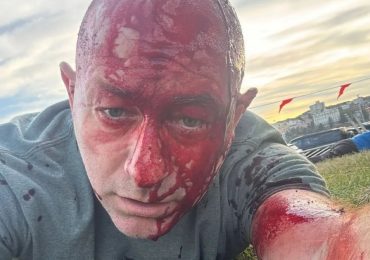 Bloodied Bondi Beach attack victim reveals seeing ‘children fall’ in ‘absolute bloodbath’ after surviving Oct 7 massacre