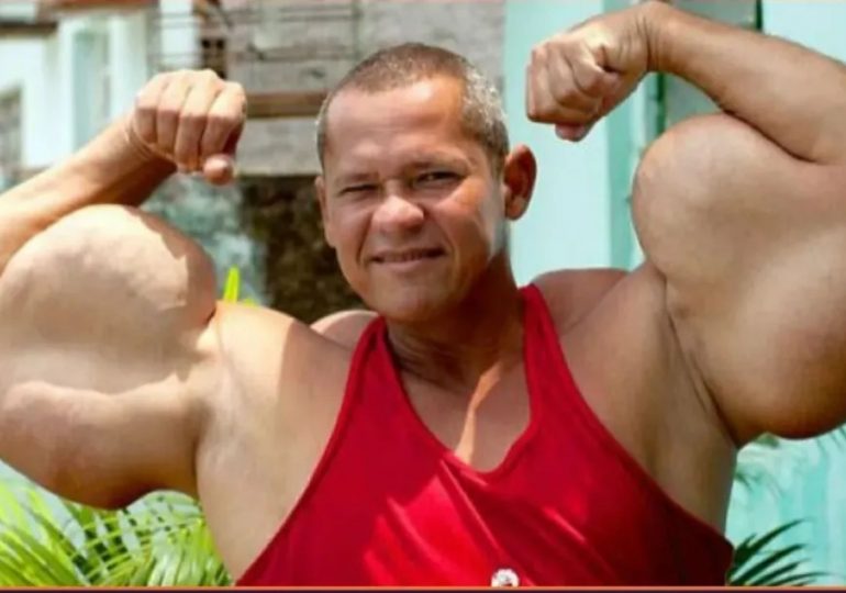 ‘Brazilian Popeye’ bodybuilder dies aged just 55 after TV star took home-made drugs & had ‘biggest biceps’ in country