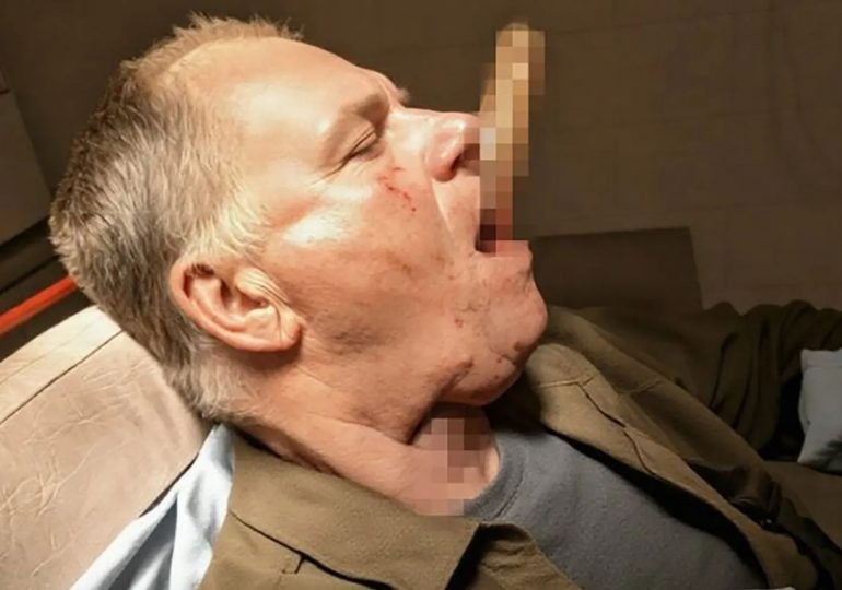 Man’s neck impaled by SHOVEL after slipping while clearing snow leaving handle sticking out of his mouth…but he survives