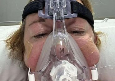 Mum, 58, fell into coma and nearly died after contracting horror disease at four-star hotel on Brit holiday island