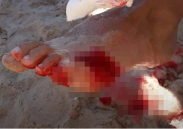 At least 40 swimmers injured in horror mass piranha attack as lifeguards order emergency evacuation