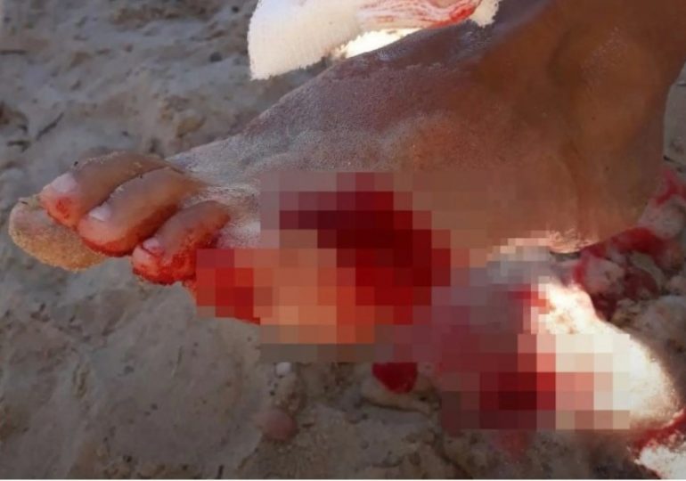 At least 40 swimmers injured in horror mass piranha attack as lifeguards order emergency evacuation