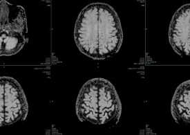 Healthcare Is AI’s Hardest Test