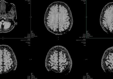 Healthcare Is AI’s Hardest Test