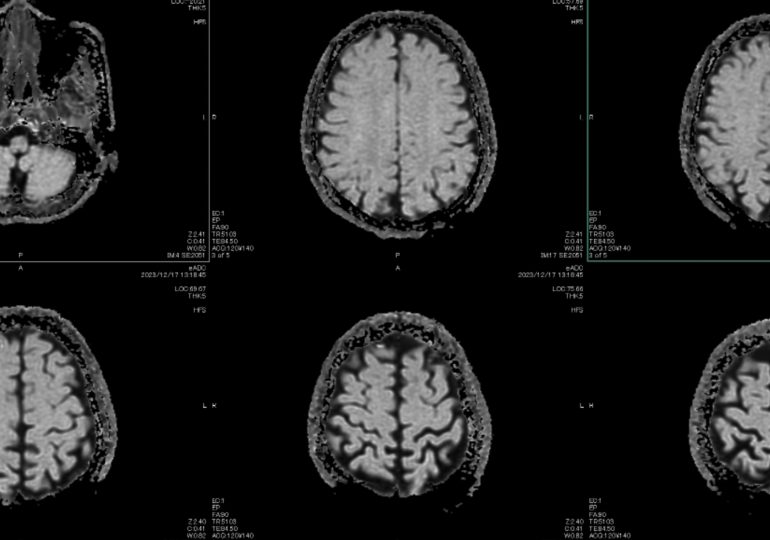 Healthcare Is AI’s Hardest Test