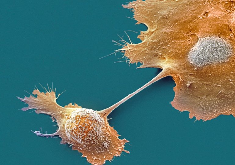 Two New Drugs Offer Hope for Pancreatic Cancer